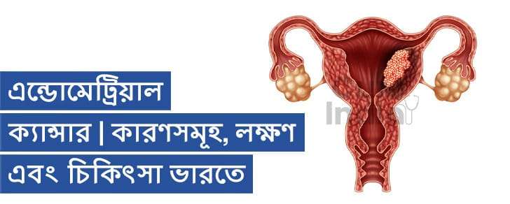 এন্ডোমেট্রিয়াল ক্যান্সার